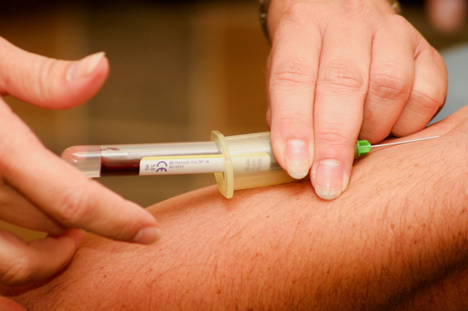 venepuncture